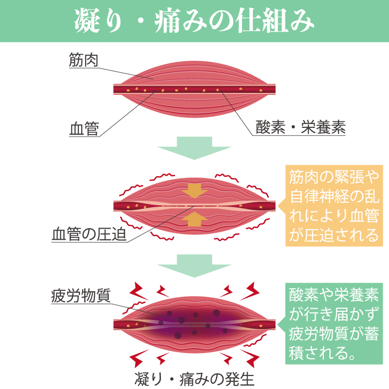 凝り・痛みの仕組みの図