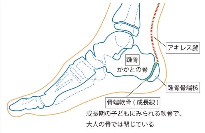 セーバー病について説明画像